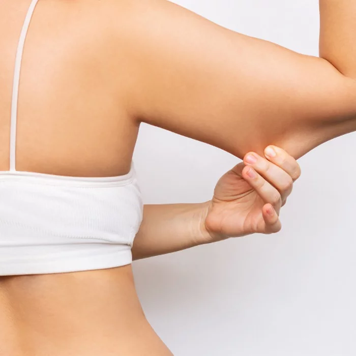 sagging skin on arms
