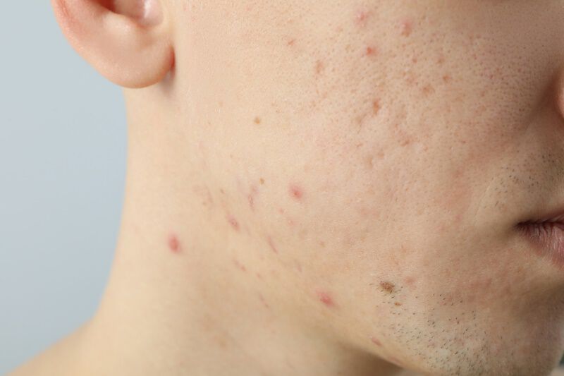 Nahaufnahme Mann schaut zur Kamera